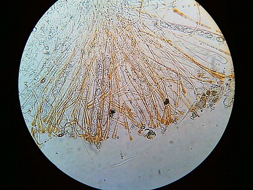 Gemeiner Orangebecherling, Aleuria aurantia