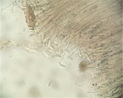 Großsporiger Gallertbecher, Ascocoryne cylichnium
