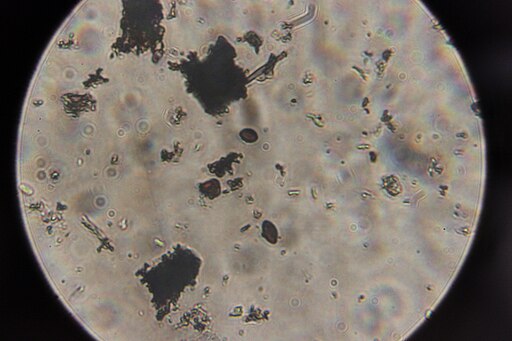 Rotbuchen-Rindenkugelpilz, Biscogniauxia nummularia
