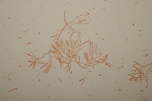Klebriger Hörnling, Calocera viscosa