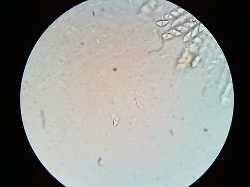 Aufsitzender Pustelpilz, Dialonectria episphaeria