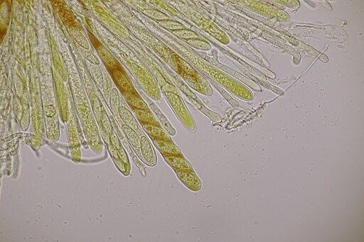 Lärchen-Nadelholzhaarbecherchen, Lachnellula occidentalis