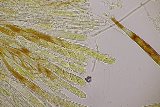 Lärchen-Nadelholzhaarbecherchen, Lachnellula occidentalis