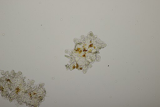 Erlen-Narrentasche, Taphrina alni