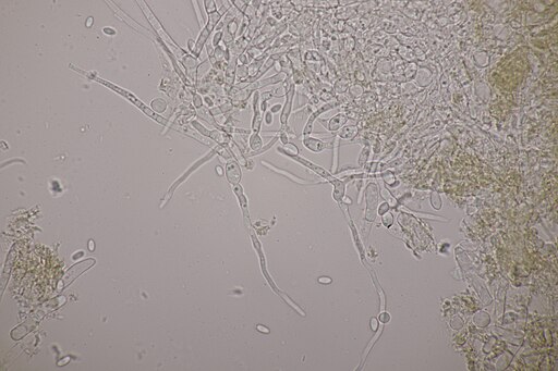 Birkenporling-Kissenpustelpilz, Trichoderma pulvinatum